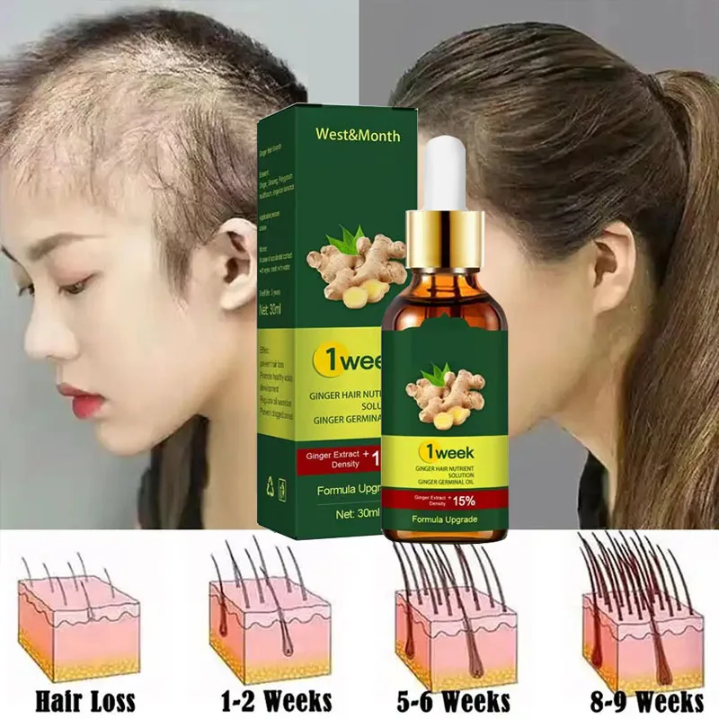 เซรั่มปลูกผมขิงสำหรับปลูกผม7วั - Licorice Root Sticks บทวิจารณ์และราคา