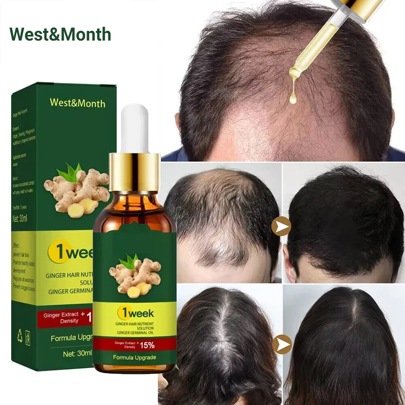 เซรั่มปลูกผมขิงสำหรับปลูกผม7วั - Licorice Root Sticks บทวิจารณ์และราคา