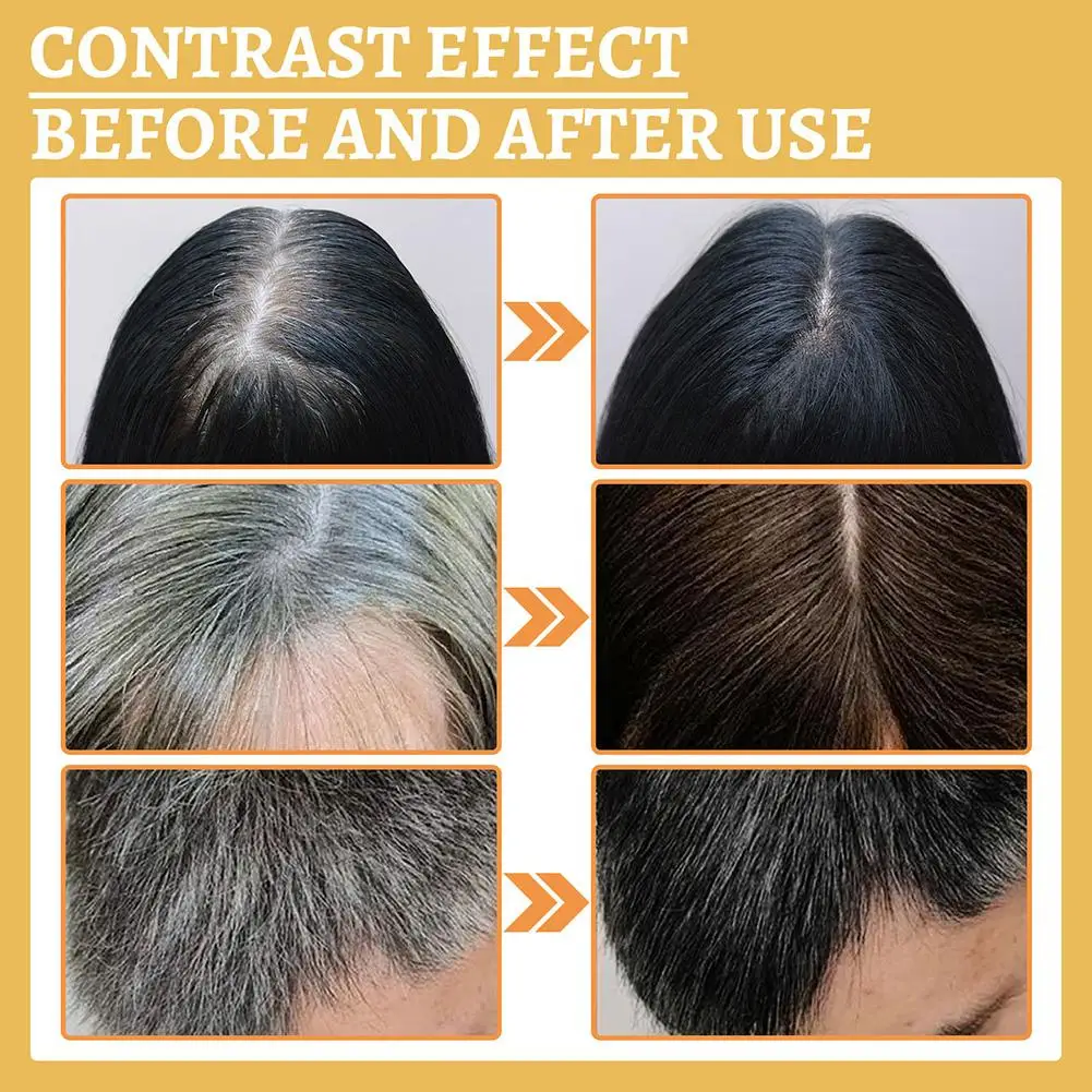 เซรั่มแก้ผมเป็นสีเทา3ชิ้นเซรั่ - Licorice Root Sticks บทวิจารณ์และราคา