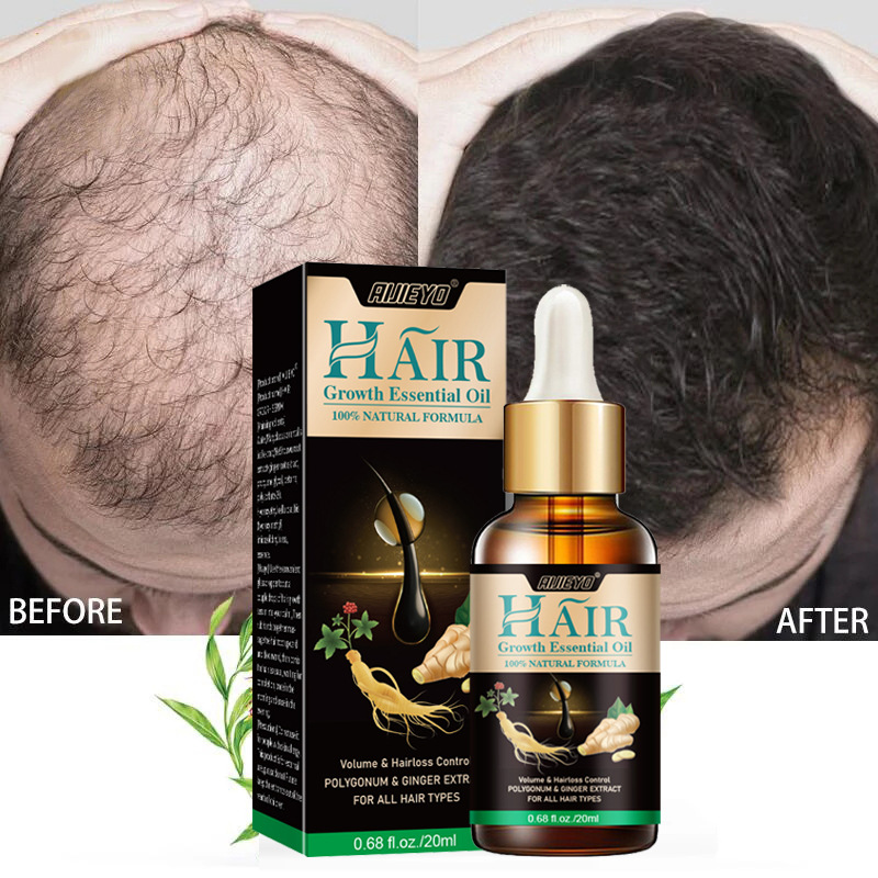 2023 Biotin Fast Hair Growth O - Licorice Root Sticks บทวิจารณ์และราคา