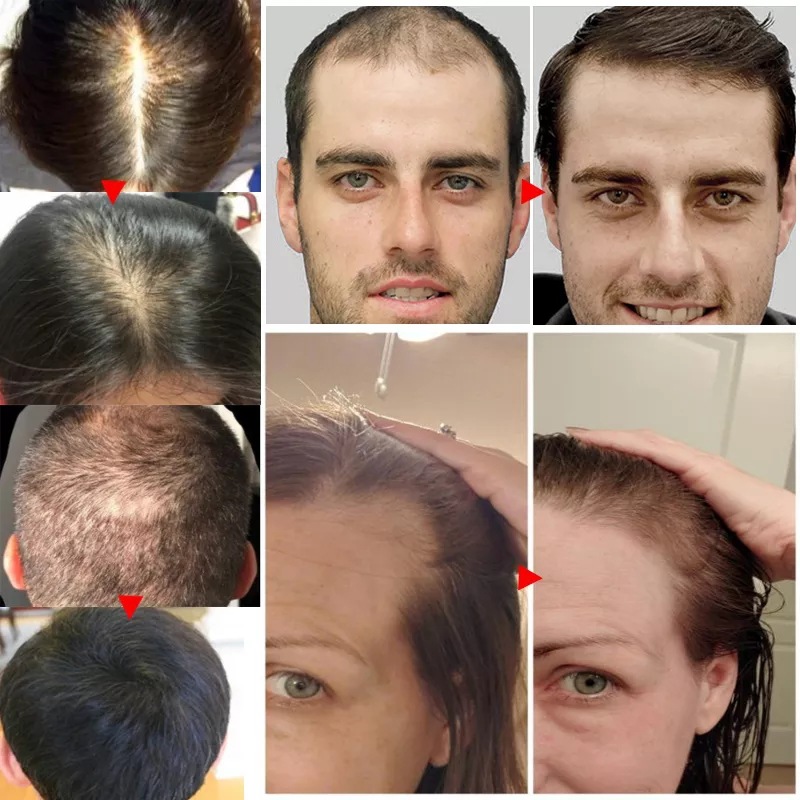 2023 Biotin Fast Hair Growth O - Licorice Root Sticks บทวิจารณ์และราคา