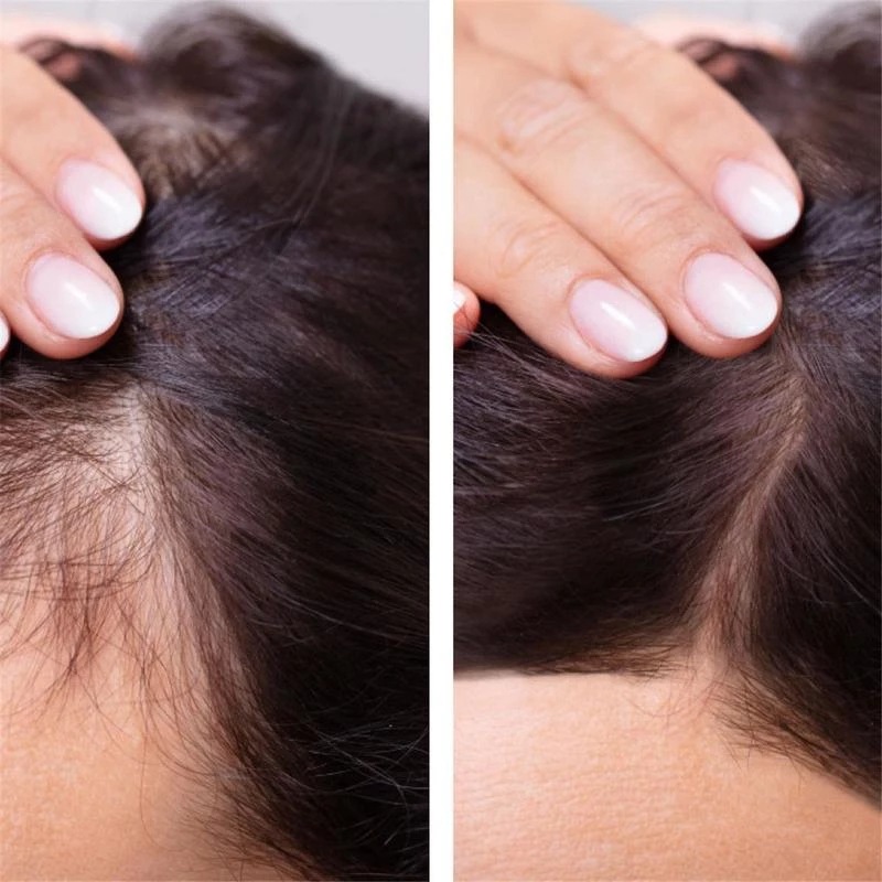 2023 Biotin Fast Hair Growth O - Licorice Root Sticks บทวิจารณ์และราคา
