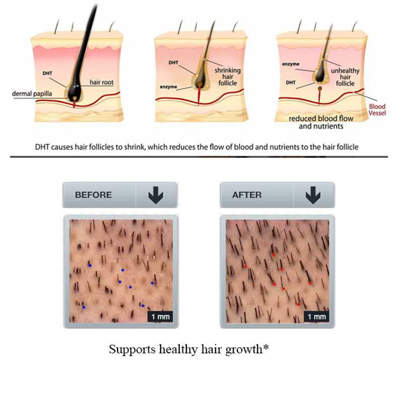 แชมพูลดผมร่วงทำจากขิง100มล. ทร - Licorice Root Sticks บทวิจารณ์และราคา